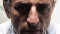 Bob Fleischner Dying